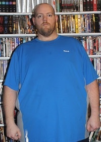 James before weight loss surgery